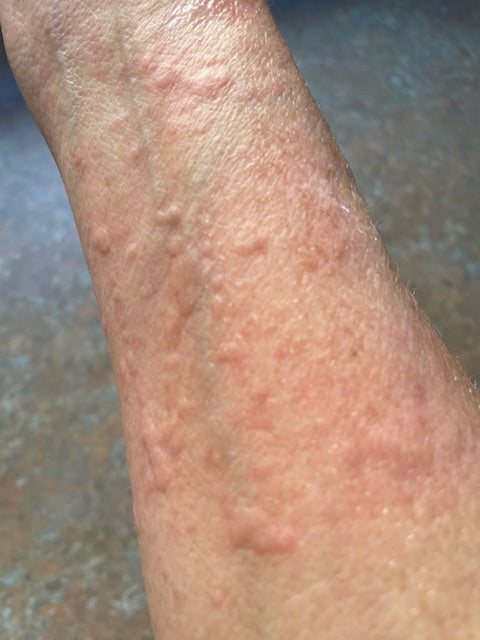 WHAT IF 'HISTAMINES' ARE ACTUALLY YOUR PROBLEM?